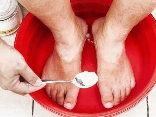 szódafürdők gomba ellen