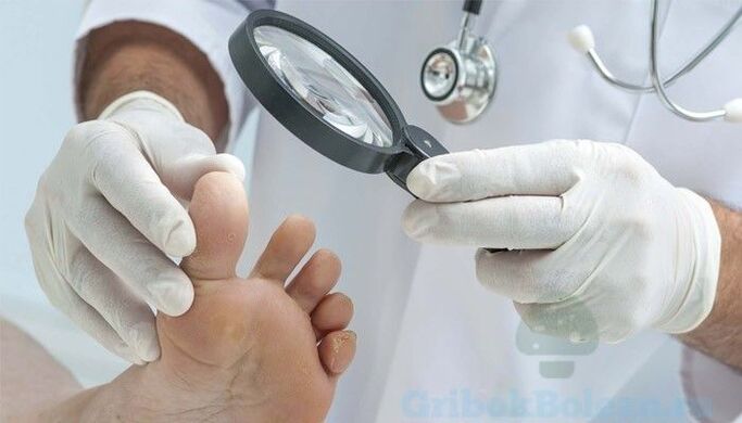 a lábgomba orvos általi diagnosztizálása