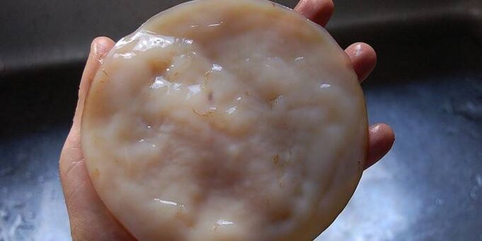 Kombucha körömgomba ellen