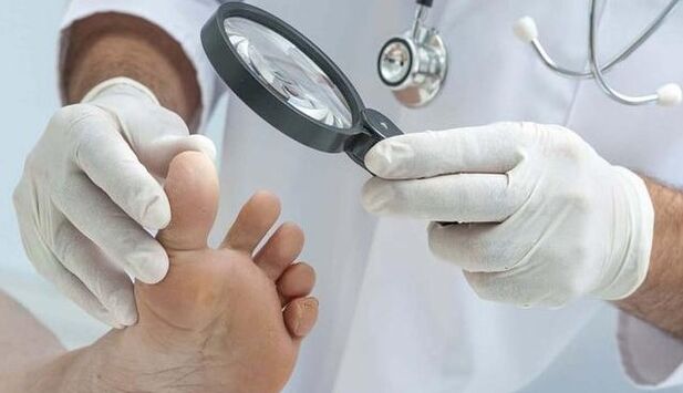 A gomba diagnosztizálása